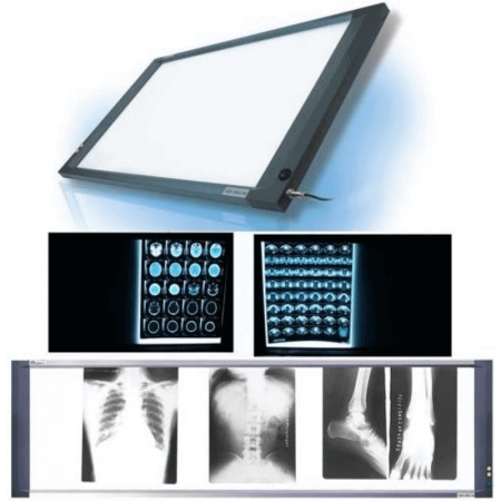 Negatoscoape - Negatoscop LED SLIM 4 panouri | Totalmed Aparatura Medicala