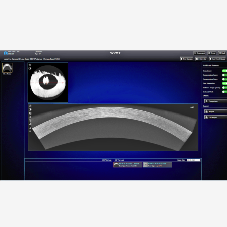 OCT/A EYEFOS 1K cu AI, tomograf în coerență optică 4K pentru diagnostic retinian și glaucom [5]