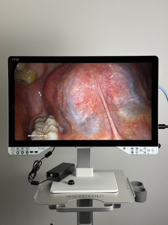 Sistem video endoscopic ALL IN ONE, 24 Inch Full HD [3]