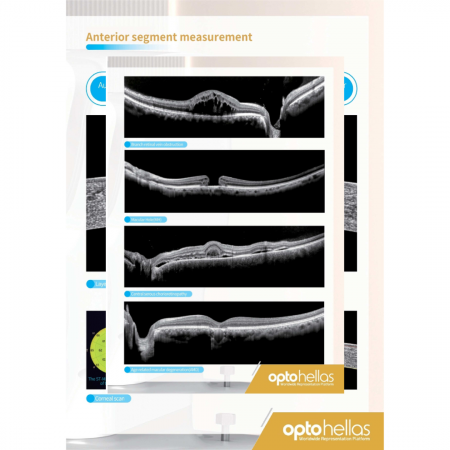 Tomograf în Coerență Optică Velite C1000 – OCT Ocular Profesionist [4]