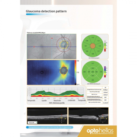 Tomograf în Coerență Optică Velite C1000 – OCT Ocular Profesionist [3]