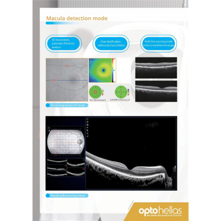 Velite C3000 Tomograf OCT 8K – imagine Ultra‑High Definition cu AI pentru diagnostic oftalmologic [3]