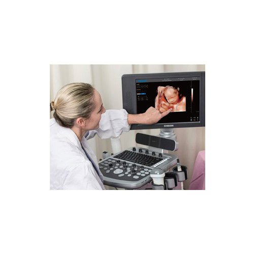 Ecograf stationar cu Doppler color QBIT 9 -Demo [5]