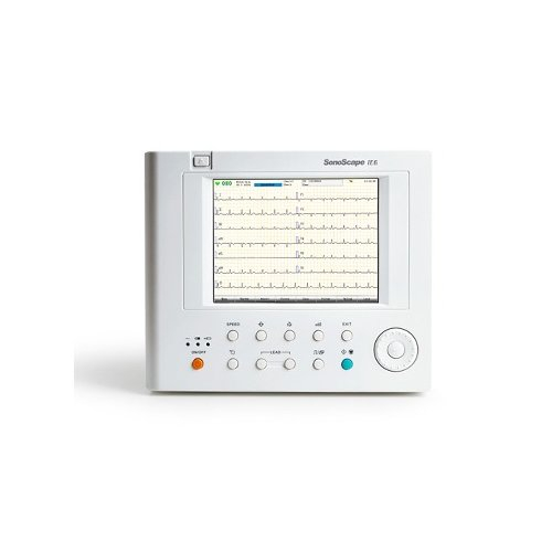 Electrocardiograf (ECG) cu 6 canale Sonoscape IE6 [2]