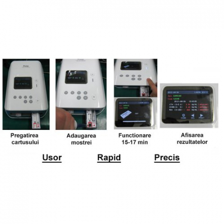 Dispozitiv pentru diagnosticarea infarctului miocardic -Smart MediPrime-Digital Optics SouthKorea [1]
