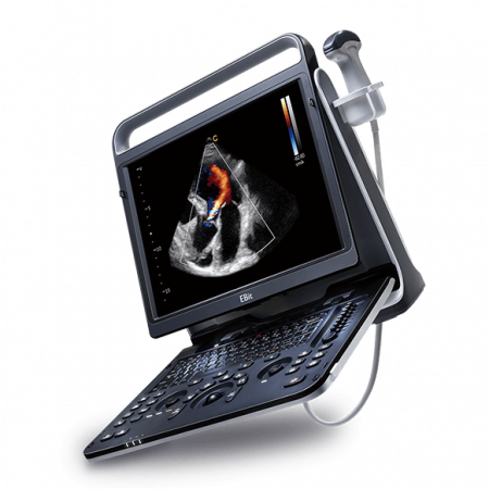 Ecografe portabile cu Doppler Color - Ecograf Ebit 60 Chison