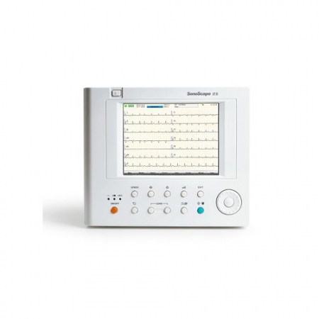 Electrocardiograf (ECG) cu 6 canale Sonoscape IE6 [1]