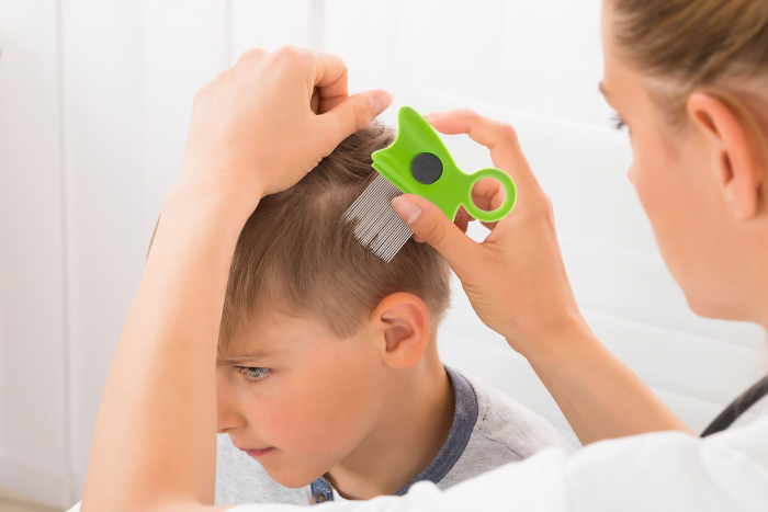 pieptene-pentru-indepartarea-paduchilor-coafura-piepteni-profesionali-par-aparatura-coafura-visuel-beauty-shop-produse-profesionale-de-infrumusetare-dotari-saloane-infrumusetarec [3]