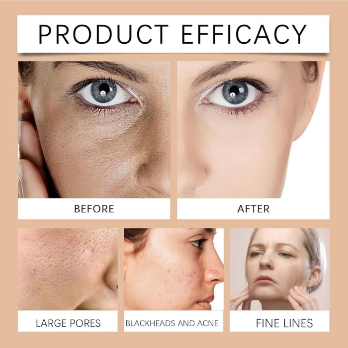Masca Faciala Peel-Off Anti-Freckle, cu Acid Hialuronic, Colagen si Glicerina, pentru Ingrijirea Tenului, 100 g [2]