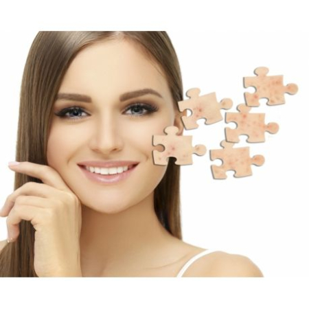 Afectiuni dermatologice (piele, par, unghii) - Acnee - tratament naturist cu produse CaliVita