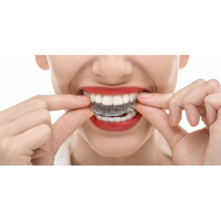 Scrasnit din dinti - bruxism - Bruxism, scrasnit din dinti
