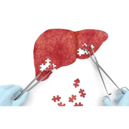 Afectiuni digestive (remedii, retete si produse naturiste) - Steatoza Hepatica (ficatul gras)