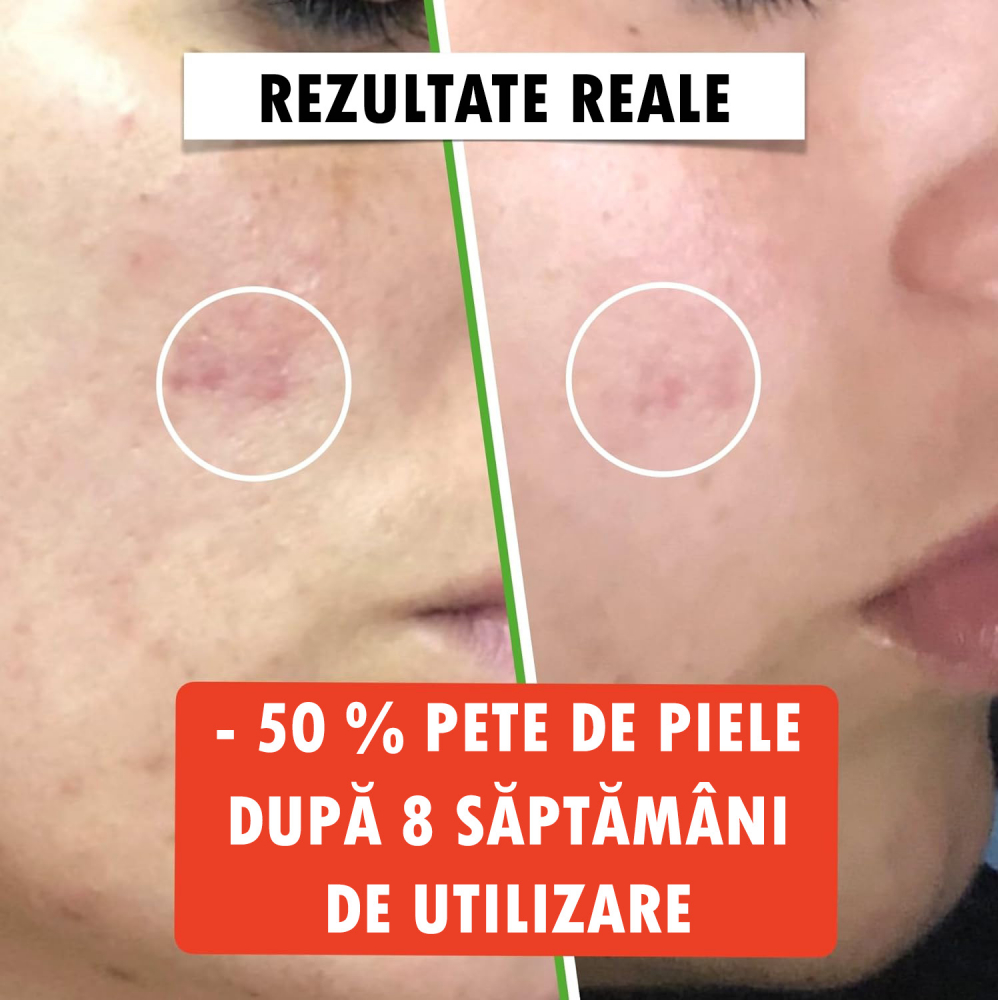 Ser cu Vitamina C, Acid Hialuronic, Vitamina E, Florence Bio, Antirid, Anti-imbatranire, iluminator, Organic, Vegan, 60ml [5]
