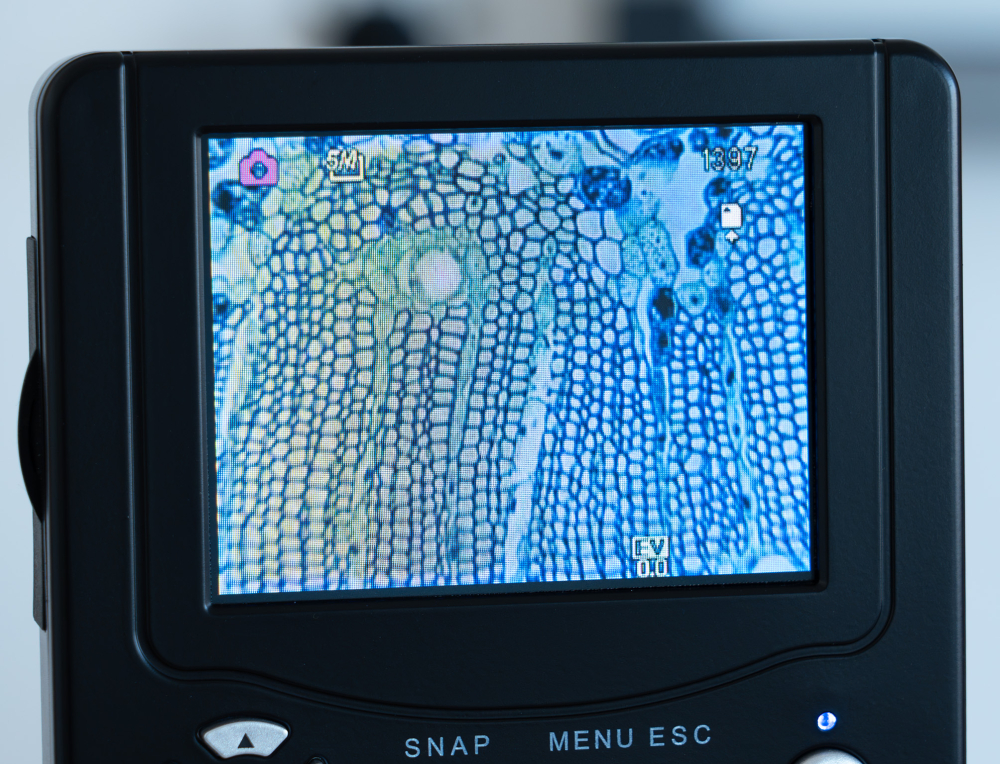 Gimnosperme – set 10 preparate microscopice [5]
