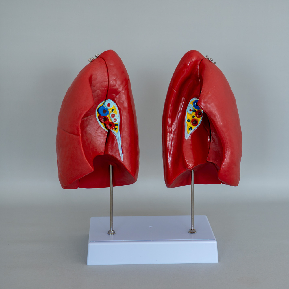 Mulaj decompozabil plămân – model anatomic [2]