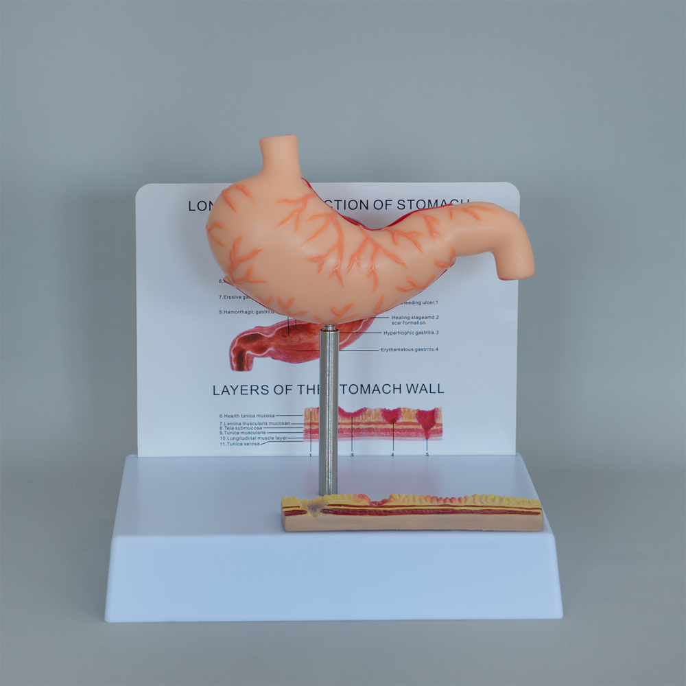 Mulaj stomac cu ulcer – model anatomic didactic [2]