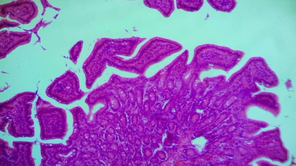 Set de 100 de preparate microscopice [7]