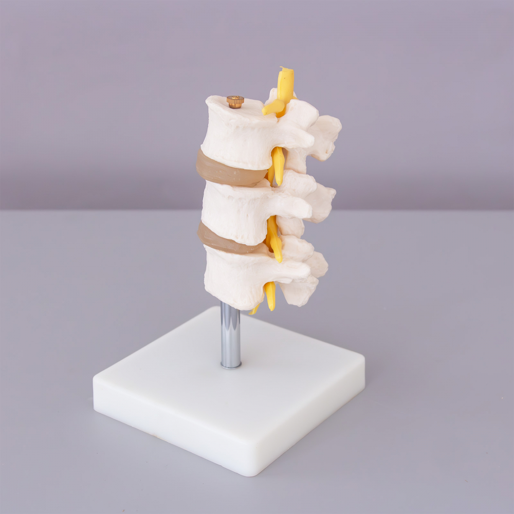 Vertebra lombara [2]
