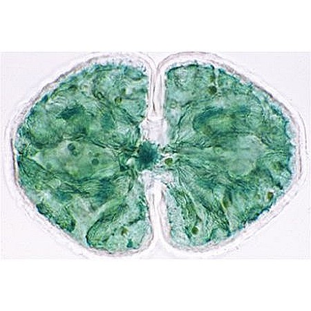 Coci – set 10 preparate microscopice [5]