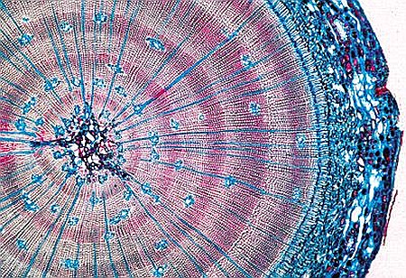 Gimnosperme – set 10 preparate microscopice [5]