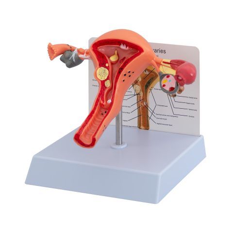 Mulaj anatomic uter – aparat reproducător feminin [0]