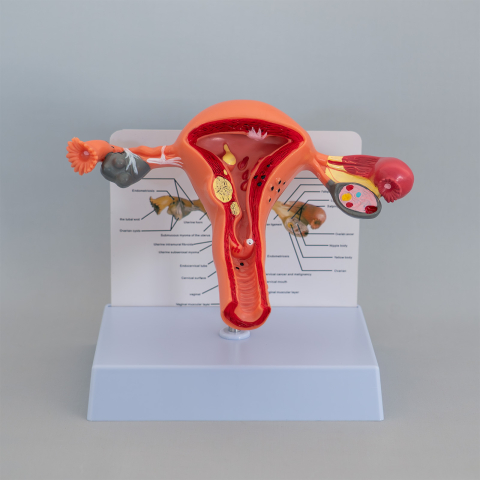 Mulaj anatomic uter – aparat reproducător feminin [1]