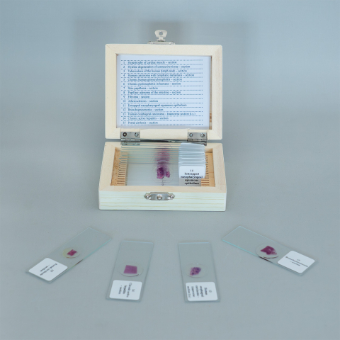 Patologii histologice umane – set 15 preparate microscopice [2]