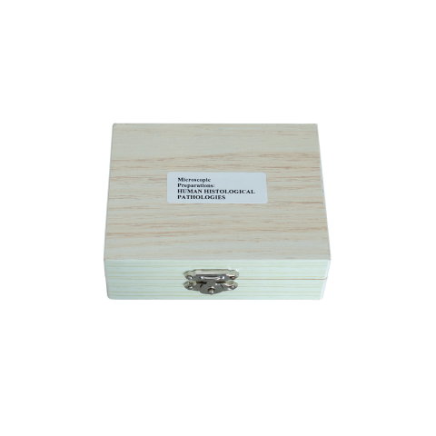 SECTIUNI MICROSCOPICE - SETURI - Patologii histologice umane – set 15 preparate microscopice