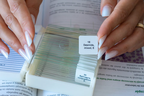 Protozoare și alge microscopice – set 20 preparate [3]