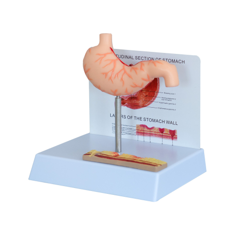 Mulaj stomac cu ulcer – model anatomic didactic [0]