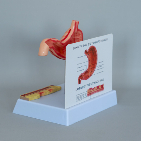 Mulaj stomac cu ulcer – model anatomic didactic [2]