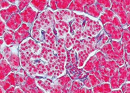 Sistemul endocrin – set de 10 preparate microscopice [4]