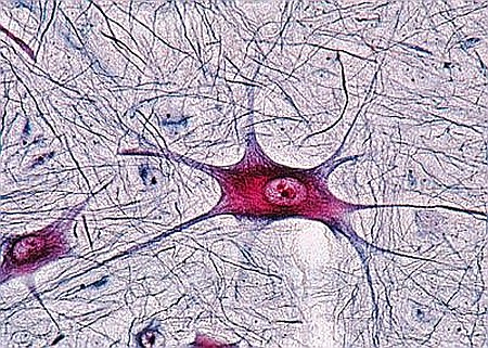 Sistemul nervos – set 10 preparate microscopice [5]