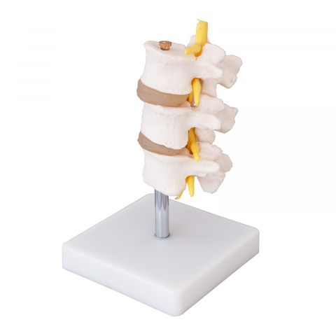 MULAJE ANATOMIE - Vertebra lombara