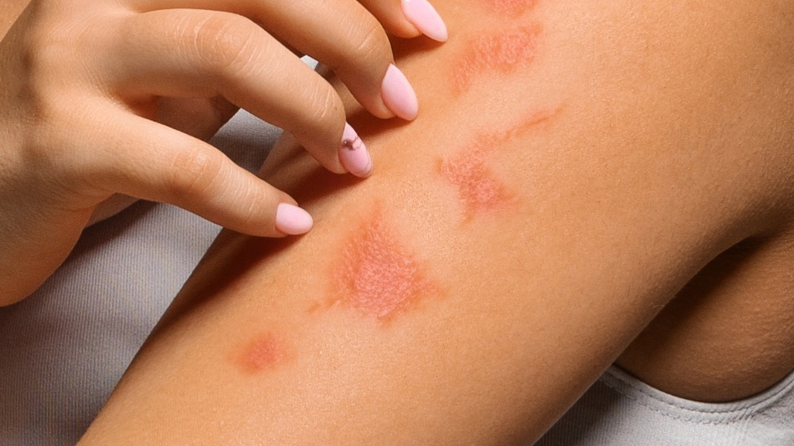 Piele sensibilă și foarte uscată. Cauze și soluții eficiente.