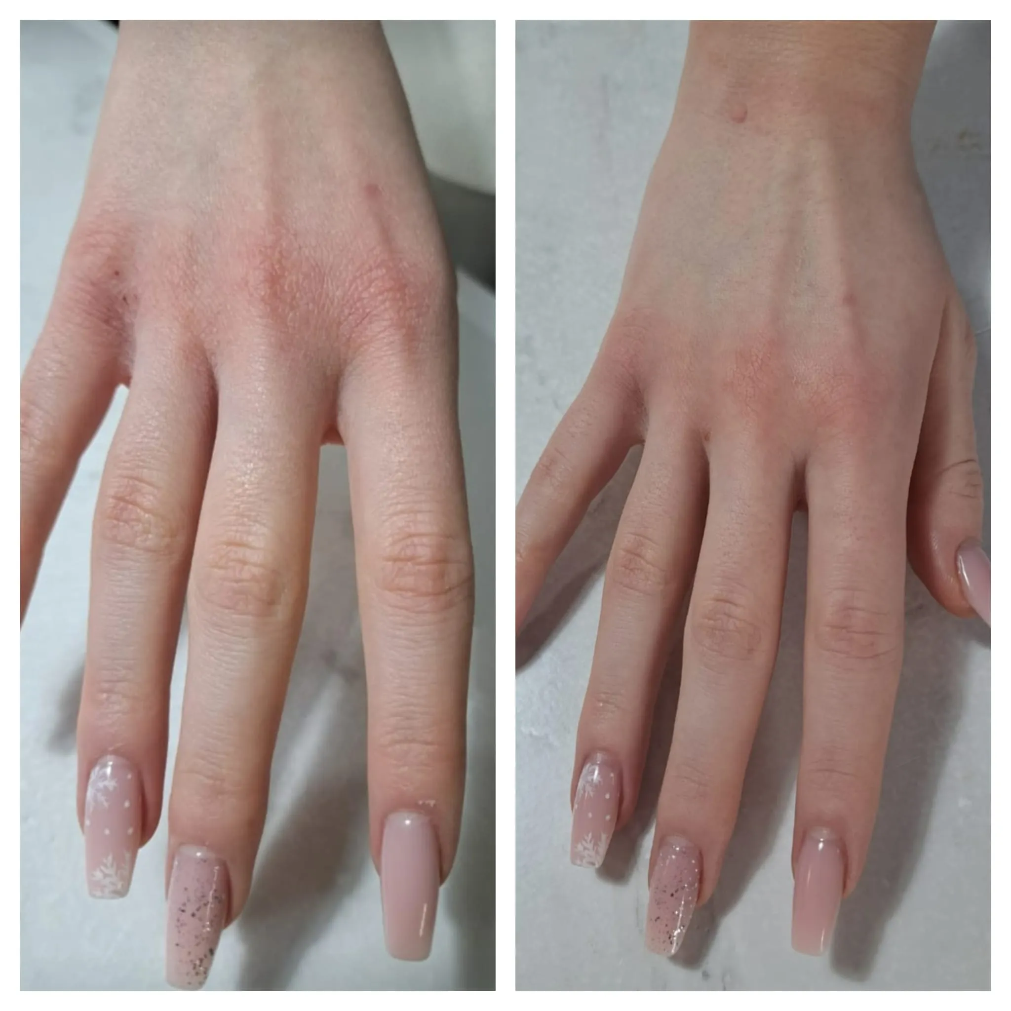 Balsam hidratant pentru piele uscata/crapata (100 ml) [1]