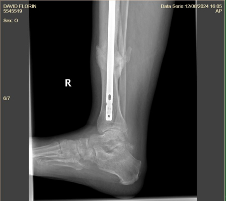 IMBRACAMINTE DAMA - Produs Exemplu