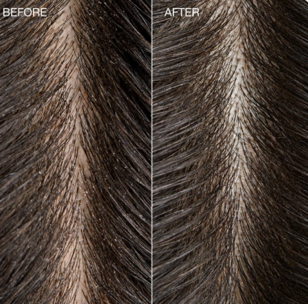 TEA TREE SPECIAL DETOX FOAMING SALT SCRUB 184GR, EXFOLIANT PENTRU SCALP [1]