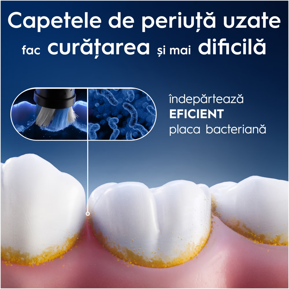 https://www.beststoreonline.ro/rezerve-periuta-de-dinti-electrica-oral-b-io-ultimate-clean-compatibile-doar-cu-seria-io-2-buc.html?preview=1 [5]