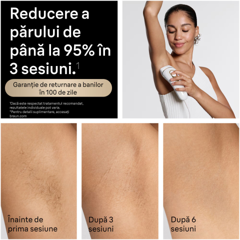 https://www.beststoreonline.ro/epilator-braun-silk-%C3%A9pil-5-5-251-wet-dry-microgrip-smart-light-28-de-pensete-2-viteze-cap-de-ras-pieptene-de-tuns-cap-pentru-incepatori-trimmer-bikini-saculet-de-voiaj-alb-flamingo.html [3]