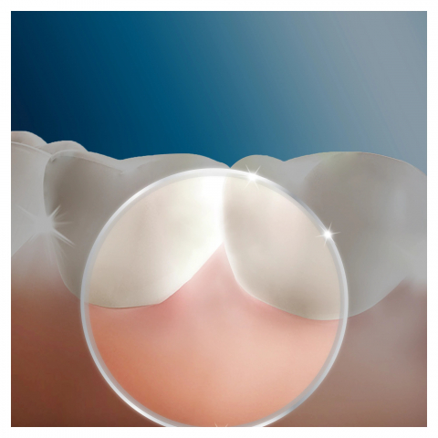 https://www.beststoreonline.ro/irigator-bucal-oral-b-5-trepte-de-intensitate-4-capete-intradentare-600-ml-alb.html?preview=1 [7]