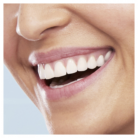 Periuta de dinti electrica Oral-B Vitality D100 Sensi Ultra Thin, 7600 Oscilatii/min, Curatare 2D, 1 program, 1 capat, Alb [3]
