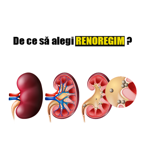 RENOREGIM – Solutia naturista pentru pietrele la rinichi si fiere