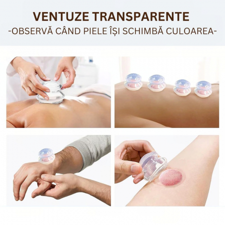 Set 4 Ventuze de Cupping, Flippy, Pentru Masaj Anticeluluitic, din Silicon, Alb Transparent [4]