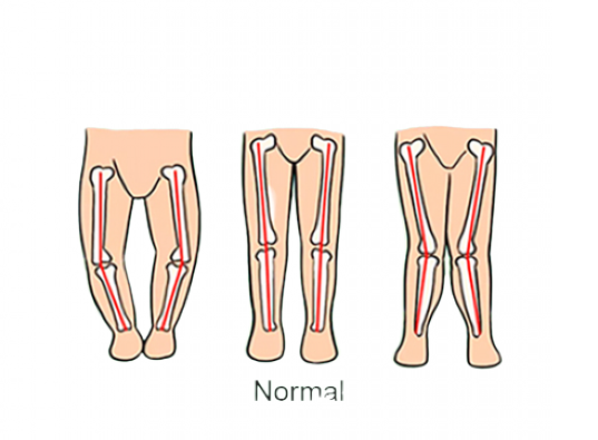 Premergator, cu roti de silicon, reglabil pe inaltime, Iepuras Coconas [3]