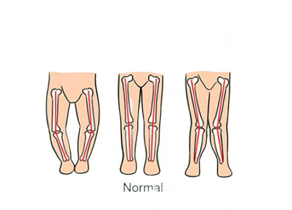 Premergator reglabil,muzical,baza rotunda stabila,Donald,vernil [3]