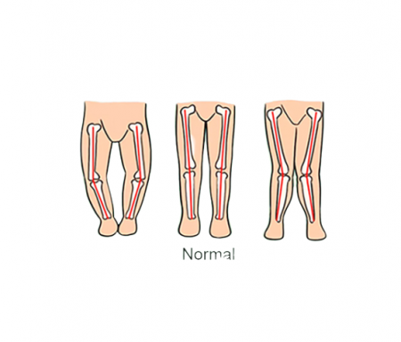 Premergator, control parental, +6 luni, rosu [1]