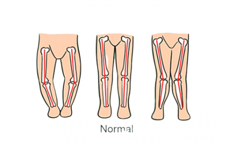 Premergator Muzical, Reglabil, Cu roti siliconate, Ratusca plimbareata [1]