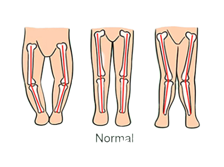 Premergator, pliabil si muzical, roz [2]