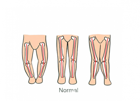 Premergator reglabil,muzical,baza rotunda stabila,Donald,vernil [2]